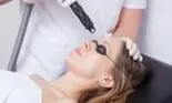 Cum scapi de cicatricele produse de acnee
