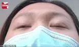 Iată cum s-a nenorocit o femeie după o operație estetică