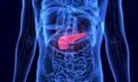 De ce e descoperit târziu cancerul pancreatic