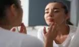 Scapă de herpesul bucal cu un ingredient-minune