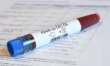 Vaccinul anti-COVID este doar o centură de siguranță, nu ne face imuni…