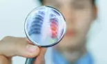 Lucrezi într-un mediu toxic? Poți face pneumonită. Iată ce este această afecțiune