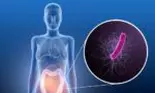 Infecția cu Clostridium Difficile: simptome și risc