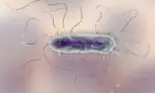 Ce este Proteus Mirabilis, bacteria greu de vindecat