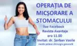 Operația de micșorare a stomacului. Cât slăbești și ce complicații pot apărea