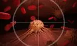 Primul om injectat cu un vaccin anti-cancer: rezultate surprinzătoare