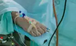 Variola maimuțelor depistată în România la un tânăr de 26 de ani. Cum se simte bărbatul?