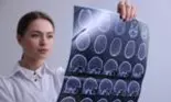 Medicamentul care încetinește boala Alzheimer a fost etichetat ca fiind „istoric'