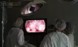 Avertisment privind cancerul la vezica urinară: picioarele umflate ar putea semnala un stadiu avansat al bolii