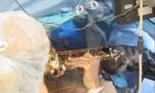 Un bărbat a cântat la saxofon în timpul operației de extirpare a unei tumori cerebrale