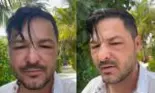 Liviu Vârciu, cu fața tumefiată în vacanță. Ce a pățit prezentatorul: „Am impresia că acum încep să mă umflu și mai tare'