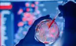 Microbiomul – secretul și cauza multor afecțiuni