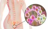 Vaginita bacteriană: cauze și tratament