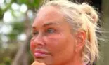 De ce s-a umflat Vica Blochina la față la Survivor România: „Aveam bube peste tot'
