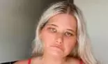 Ce este sindromul Moebius? O femeie a demonstrat că frumusețea poate căpăta sensuri diferite