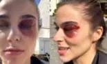Theo Rose a apărut cu ochiul vânăt. Mesajul transmis de artistă: „Cum am ajuns în situația asta?'