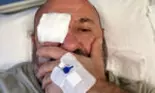 Cătălin Scărlătescu, cu ochiul pansat și cu perfuzia în mănă. Bucătarul a ajuns la spital: „Am avut oaspeți…'