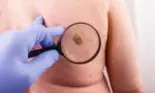 O suceveancă de 36 de ani, însărcinată în luna a treia, a murit la spital. Femeia nu știa că avea cancer cu metastaze, ca urmare a ruperii unei alunițe