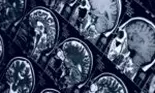 Oamenii de știință avertizează că trei alimente banale ar putea conține paraziți care pot ajunge ușor în creier provocând infecții parazitare