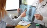 Cum contracarezi efectele unei radiografii?