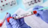 Mpox nu este noul Covid, deoarece autoritățile pot controla răspândirea, subliniază OMS