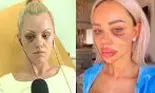 Vedetele din România, victime ale violenței domestice. Au povestit public prin ce au trecut