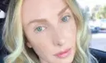 Un model împărtășește inedita ipostază de a fi unită cu sora sa geamănă în uterul mamei sale