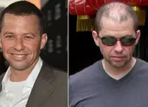 Jon Cryer din “Doi bărbaţi şi jumătate” e... aproape chel!