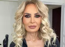 Operațiile estetice pe care Daniela Gyorfi le regretă. „După trei intervenții, nu sunt mulțumită”