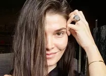 Alina Pușcaș și-a spart unul dintre dinții din față: „V-aș arăta, dar totuși mi-e rușine”