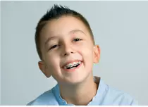 5 sfaturi pentru a-ți ajuta copilul să poarte aparat dentar