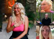De ce concurentele de la „Survivor” ajung să aibă fața umflată, deși mănâncă doar orez și cocos. Explicațiile medicului