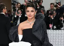 Priyanka Chopra Jonas, desfigurată din cauza unei operații nereușite. „Am intrat într-o depresie foarte profundă”
