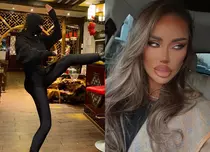 Cum arată Bianca Drăgușanu după cea mai recentă operație estetică. A renunțat la cagulă: „Sunt frumușică!”