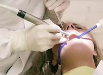 Top 5 greșeli pe care le facem iarna și care ne distrug zâmbetul fără să ne dăm seama