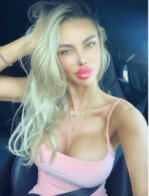 Bianca Drăgușanu și-a mărit, din nou, buzele. Cum arată acum: unii spun că îi stă bine, alții că a exagerat