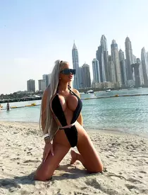 Loredana-Chivu-operatie-liposuctie-1