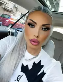 După ce s-a îngrășat, Loredana Chivu a ajuns pe masa de operație: "Nu m-am simțit niciodată grasă"