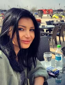 Roxana Vancea, dupa operatia la nas