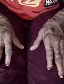 O tânără trece prin probleme grave cu pielea sa