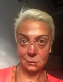 Monica Anghel, accident șocant! Artista a fost aproape desfigurată în urma unei căzături de pe cal