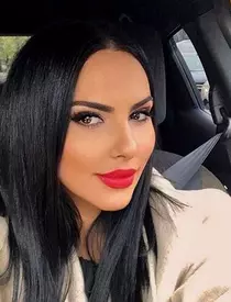 Lavinia Pârva susține că nu și-a făcut decât intervenții estetice minim invazive.