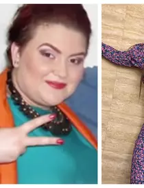 oana-radu-interventii-estetice