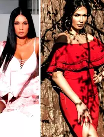 Nicoleta-Luciu-operatii-estetice-3