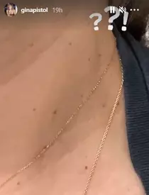 gina pistol probleme de sănătate