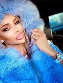 1Bianca-Dragusanu-operatii-estetice-2