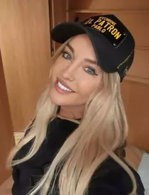 Tania-Budi-operatie-estetica-1