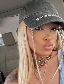 ema-uta-operatii-estetice-1