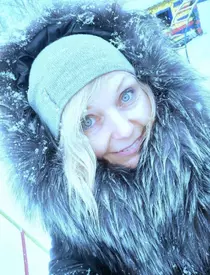 Femeia rănită din Ucraina, adevărul despre poza cu ea, devenită virală: „Totul este real. Iată bucățile de sticlă care au rămas în mine”