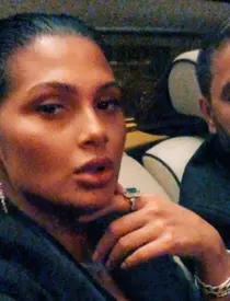 roxana-dobre-interventie-estetica-1